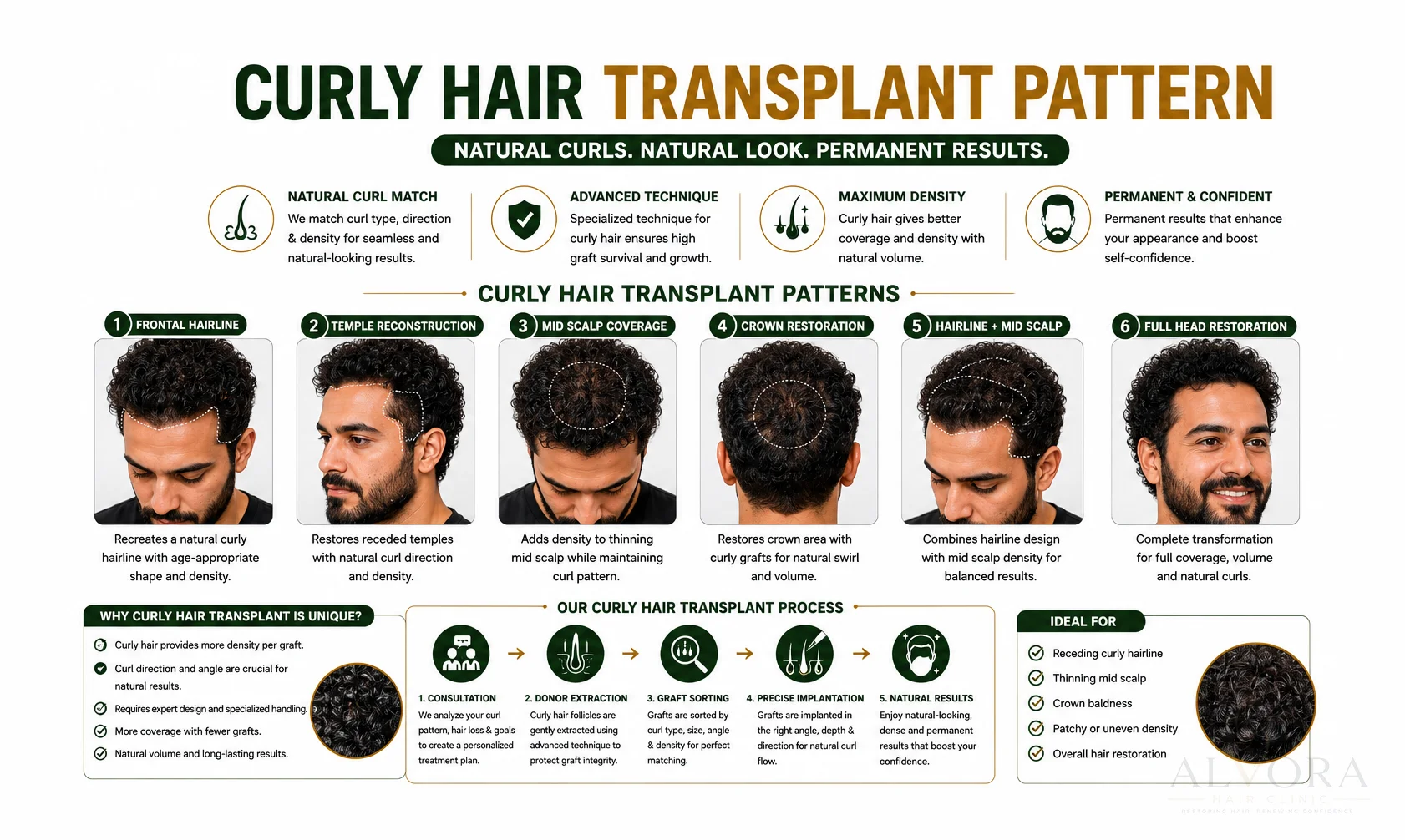 Curly Hair Transplant in Ludhiana Loss Patterns Infographic