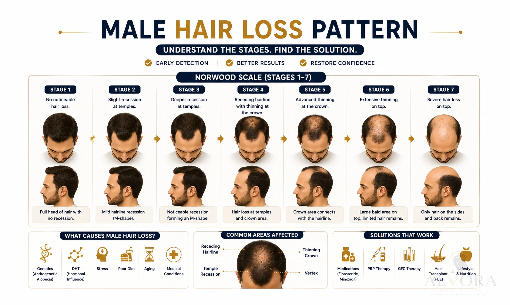 Alvora Hair Clinic Norwood Scale Male Hair Loss Pattern Chart