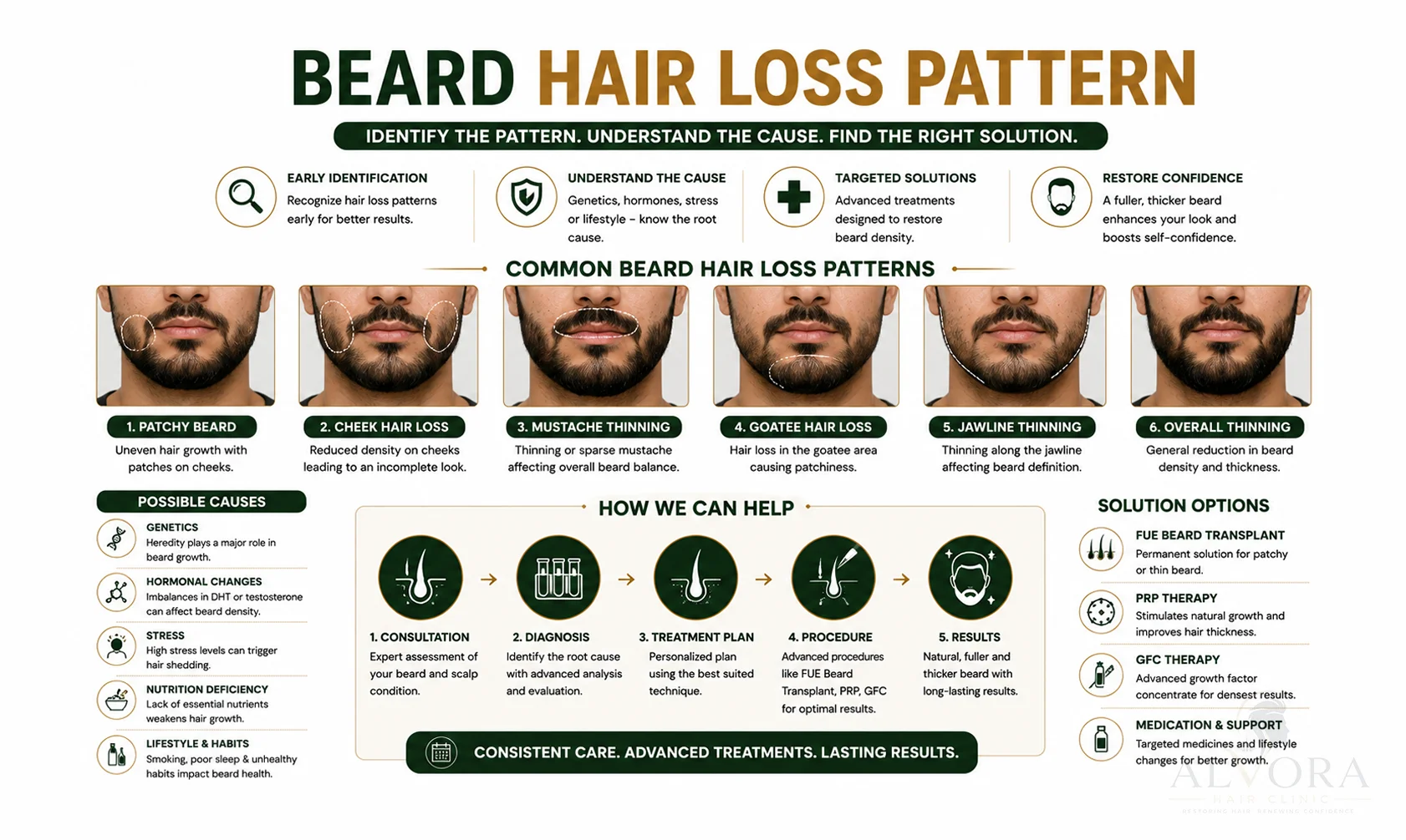 Beard Hair Transplant in Ludhiana Loss Patterns Infographic