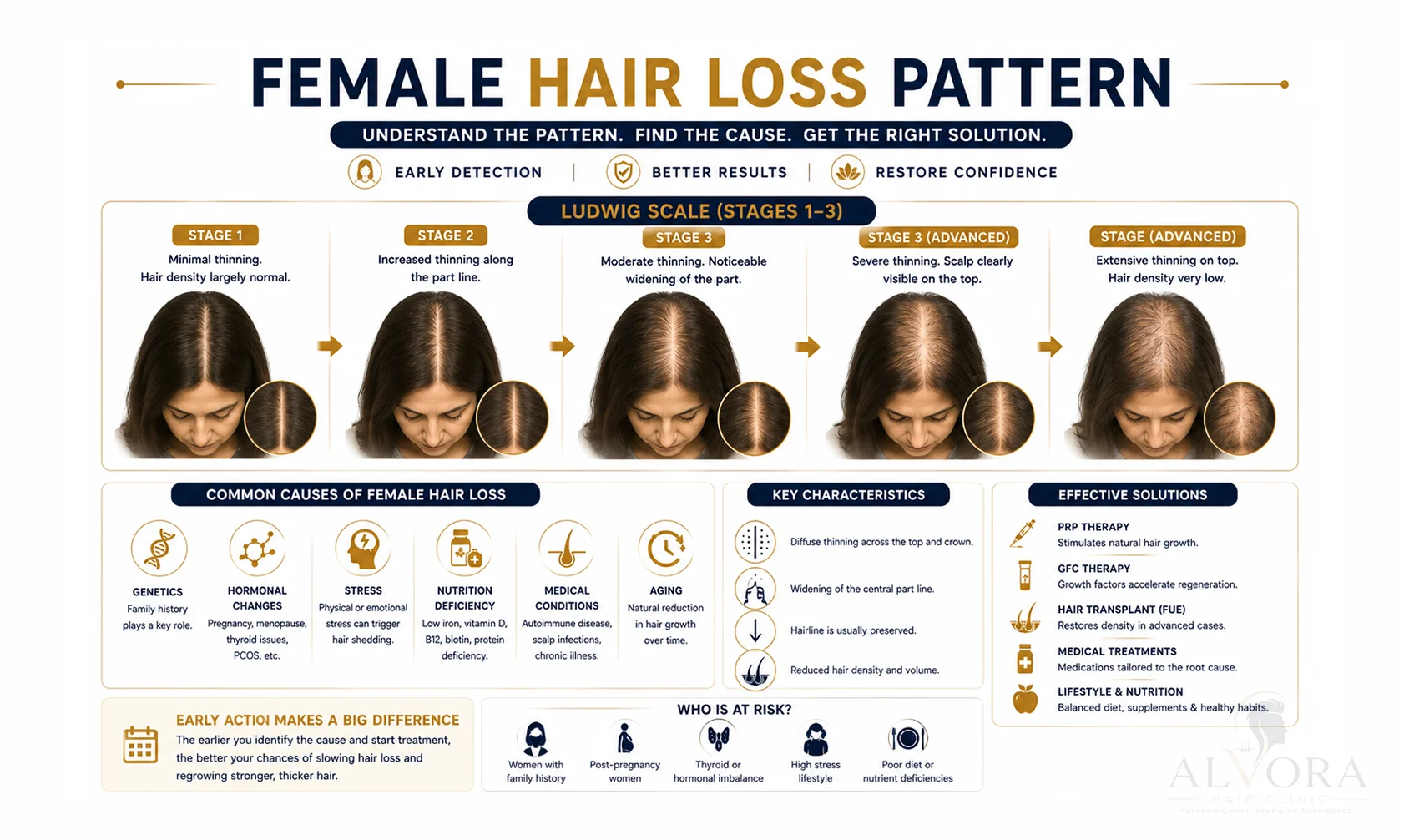 Female Hair Transplant in Ludhiana Ludwig Scale Chart